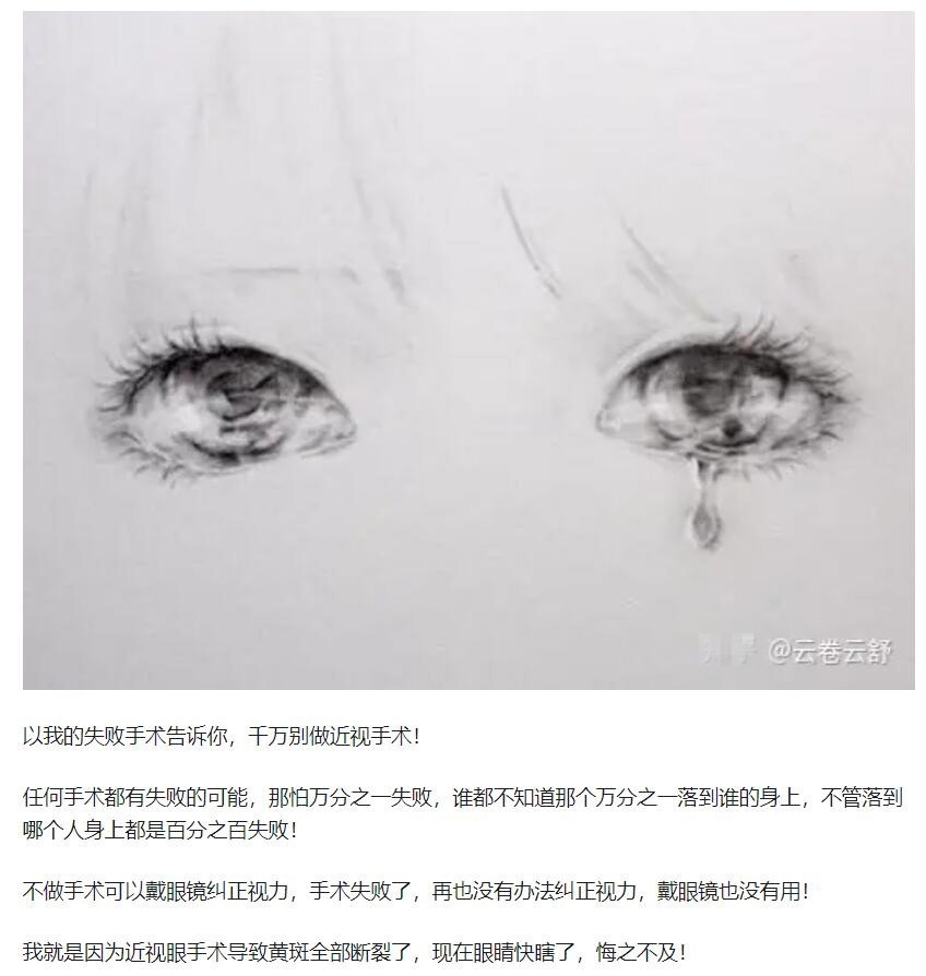 教你，怎樣去了解近視手術(shù)  